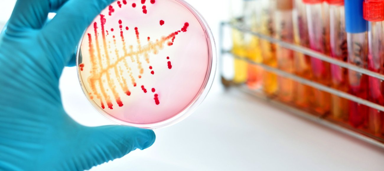 Microbiology Testing Services: Ensuring Safety and Compliance