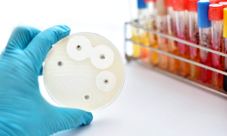 Image of MIC testing for tailoring antibiotic potency