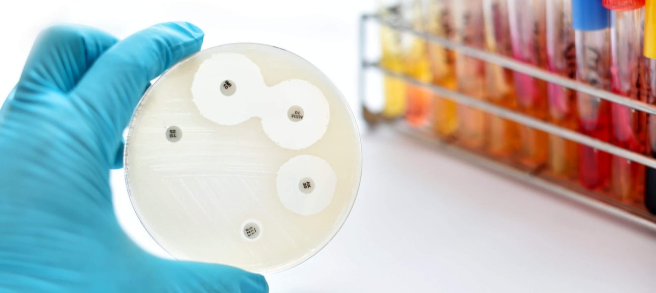 Image of MIC testing for tailoring antibiotic potency