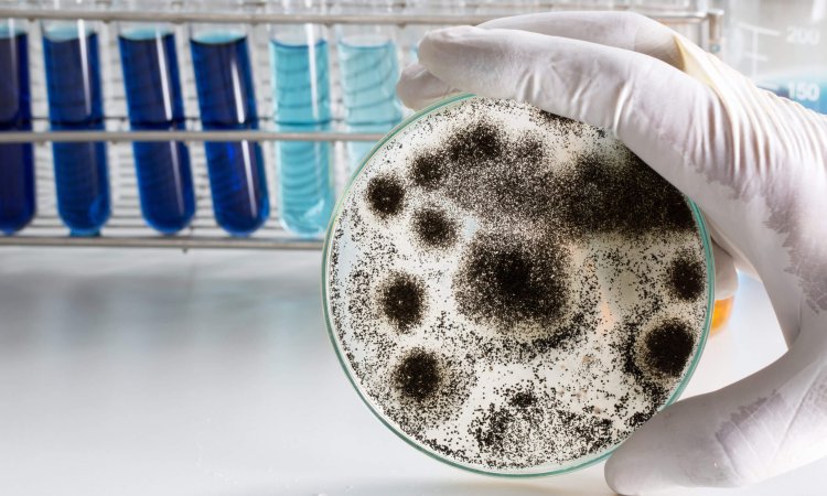 Aspergillus,(mold),For,Microbiology,In,Lab.