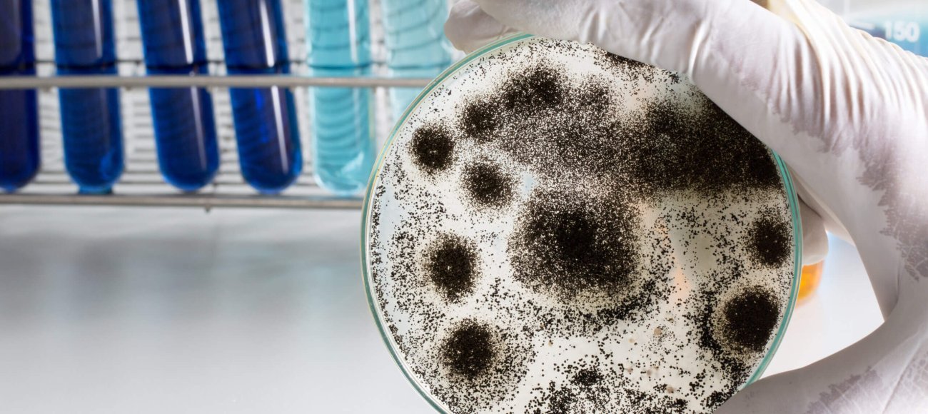 Aspergillus,(mold),For,Microbiology,In,Lab.